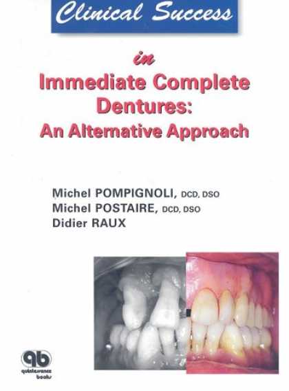 Books About Success - Clinical Success in Immediate Complete Dentures: An Alternative Approach