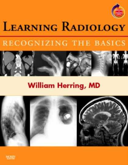 Books on Learning and Intelligence - Learning Radiology: Recognizing the Basics: With STUDENT CONSULT Online Access