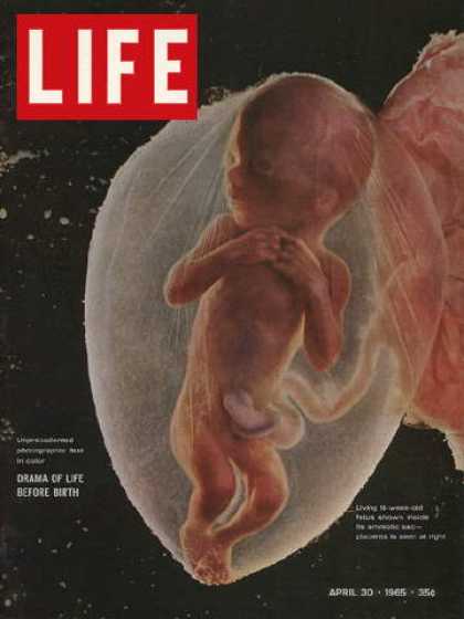 Life - 18-week fetus
