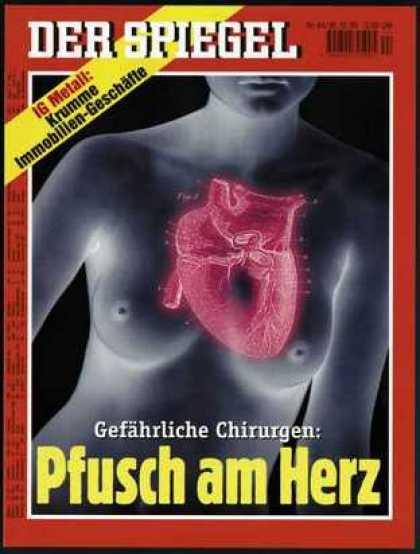 Spiegel - Der SPIEGEL 44/1995 -- Herzoperationen